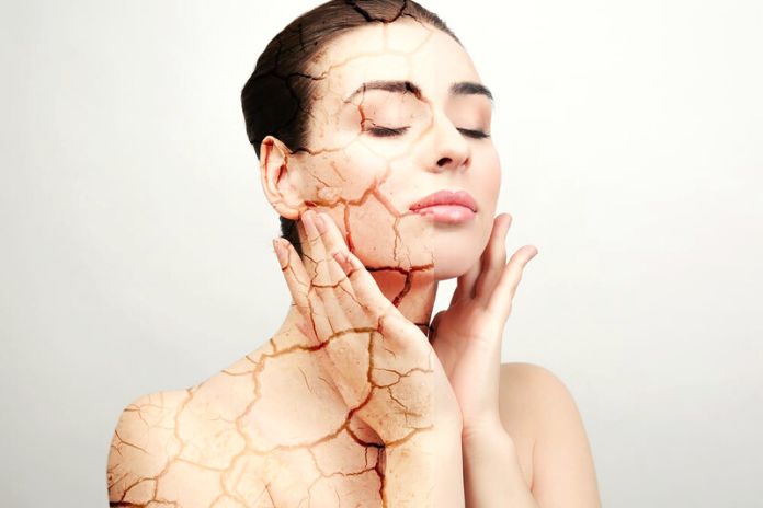 Xerosis: Here Are All The Tips For Treating Dehydrated Skin